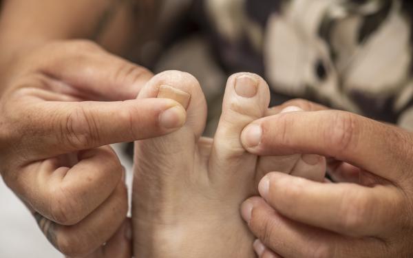 Diabetes voetcontrole
